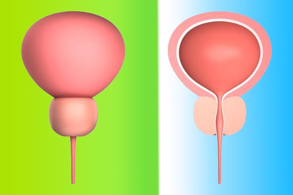  前列腺疾病会导致精子活力低下吗